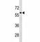 Transcription Factor EB antibody, F46977-0.4ML, NSJ Bioreagents, Western Blot image 