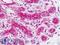 Cadherin 4 antibody, LS-B8990, Lifespan Biosciences, Immunohistochemistry paraffin image 