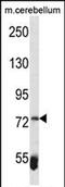 Zinc Finger And BTB Domain Containing 39 antibody, PA5-72060, Invitrogen Antibodies, Western Blot image 