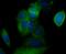 Calcium Voltage-Gated Channel Auxiliary Subunit Gamma 4 antibody, NBP2-76920, Novus Biologicals, Immunocytochemistry image 
