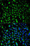 Prohibitin antibody, STJ24977, St John