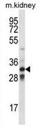 T Cell Leukemia Homeobox 1 antibody, AP54272PU-N, Origene, Western Blot image 
