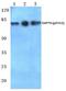 Zeta Chain Of T Cell Receptor Associated Protein Kinase 70 antibody, PA5-36884, Invitrogen Antibodies, Western Blot image 