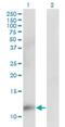 CDC28 Protein Kinase Regulatory Subunit 2 antibody, H00001164-M02, Novus Biologicals, Western Blot image 