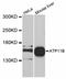 ATPase Phospholipid Transporting 11B (Putative) antibody, abx125548, Abbexa, Western Blot image 