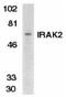 Interleukin 1 Receptor Associated Kinase 2 antibody, TA306017, Origene, Western Blot image 