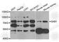 GRB2 Associated Binding Protein 1 antibody, A6248, ABclonal Technology, Western Blot image 
