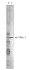 Respiratory Syncytial Virus Nucleoprotein  antibody, NBP2-50535, Novus Biologicals, Western Blot image 