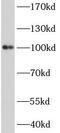 Actinin Alpha 3 (Gene/Pseudogene) antibody, FNab00122, FineTest, Western Blot image 