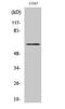 Gamma-aminobutyric acid receptor subunit beta-1 antibody, STJ90736, St John