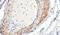 Actin Alpha 2, Smooth Muscle antibody, GTX89701, GeneTex, Immunohistochemistry paraffin image 