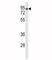 Low Density Lipoprotein Receptor antibody, F51451-0.4ML, NSJ Bioreagents, Western Blot image 