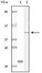 Calcium And Integrin Binding 1 antibody, NBP1-47401, Novus Biologicals, Western Blot image 