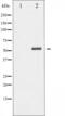 Checkpoint Kinase 2 antibody, abx010986, Abbexa, Western Blot image 