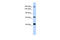 ATP Binding Cassette Subfamily C Member 9 antibody, 25-884, ProSci, Western Blot image 