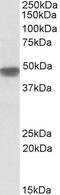 NADH:Ubiquinone Oxidoreductase Core Subunit S2 antibody, PA5-19342, Invitrogen Antibodies, Western Blot image 