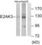 Eukaryotic Translation Initiation Factor 2 Alpha Kinase 3 antibody, abx013820, Abbexa, Western Blot image 
