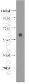 Hyaluronidase 2 antibody, 51148-1-AP, Proteintech Group, Western Blot image 