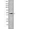 Tumor Susceptibility 101 antibody, abx219155, Abbexa, Western Blot image 