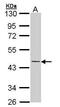 Keratin 19 antibody, PA5-29548, Invitrogen Antibodies, Western Blot image 
