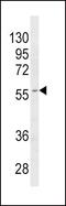 Cytochrome P450 Family 4 Subfamily B Member 1 antibody, PA5-35352, Invitrogen Antibodies, Western Blot image 