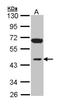 Inositol Polyphosphate-1-Phosphatase antibody, NBP1-31475, Novus Biologicals, Western Blot image 