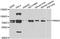 Interleukin 1 Receptor Associated Kinase 2 antibody, A6635, ABclonal Technology, Western Blot image 