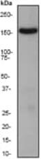 Rho Associated Coiled-Coil Containing Protein Kinase 1 antibody, ab134181, Abcam, Western Blot image 