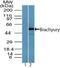 T antibody, NBP2-24676, Novus Biologicals, Western Blot image 