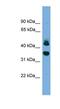 Sorting Nexin 32 antibody, NBP1-79591, Novus Biologicals, Western Blot image 