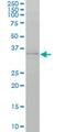 SNCG antibody, H00006964-M01, Novus Biologicals, Western Blot image 