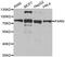 Poly(A)-Specific Ribonuclease antibody, abx005267, Abbexa, Western Blot image 