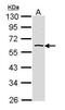 AKT Serine/Threonine Kinase 3 antibody, PA5-29696, Invitrogen Antibodies, Western Blot image 