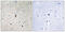 3-Phosphoinositide Dependent Protein Kinase 1 antibody, 79-833, ProSci, Immunohistochemistry paraffin image 