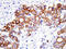 Glutamate-Cysteine Ligase Catalytic Subunit antibody, LS-C312650, Lifespan Biosciences, Immunohistochemistry paraffin image 