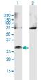 Polypeptide N-Acetylgalactosaminyltransferase 9 antibody, H00050614-B01P, Novus Biologicals, Western Blot image 