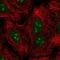 GLI Family Zinc Finger 2 antibody, NBP2-57535, Novus Biologicals, Immunocytochemistry image 