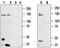 Transient Receptor Potential Cation Channel Subfamily M Member 8 antibody, TA328652, Origene, Western Blot image 