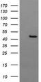 Gamma-Butyrobetaine Hydroxylase 1 antibody, TA505788S, Origene, Western Blot image 