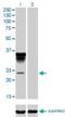 Alpha-1-acid glycoprotein antibody, H00005004-M01, Novus Biologicals, Western Blot image 