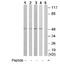 Interleukin 13 Receptor Subunit Alpha 1 antibody, ab79277, Abcam, Western Blot image 