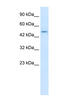 Zinc Finger And BTB Domain Containing 47 antibody, MBS833818, MyBioSource, Western Blot image 