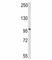 DExD/H-Box Helicase 58 antibody, F46992-0.4ML, NSJ Bioreagents, Western Blot image 