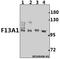 Coagulation factor XIII A chain antibody, A02047, Boster Biological Technology, Western Blot image 