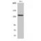 DEAH-Box Helicase 8 antibody, LS-C383109, Lifespan Biosciences, Western Blot image 