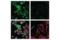 Coronin 1A antibody, 92904S, Cell Signaling Technology, Immunofluorescence image 