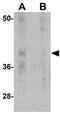 Programmed Cell Death 1 antibody, GTX17271, GeneTex, Western Blot image 