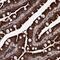 Progesterone Receptor Membrane Component 2 antibody, NBP2-49289, Novus Biologicals, Immunohistochemistry paraffin image 