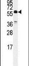 Cell Division Cycle 25C antibody, PA5-15024, Invitrogen Antibodies, Western Blot image 