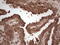 Mesothelin antibody, LS-C339470, Lifespan Biosciences, Immunohistochemistry frozen image 